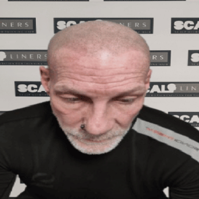 Scalpliners Scalp Micropigmentaion Kent Logo