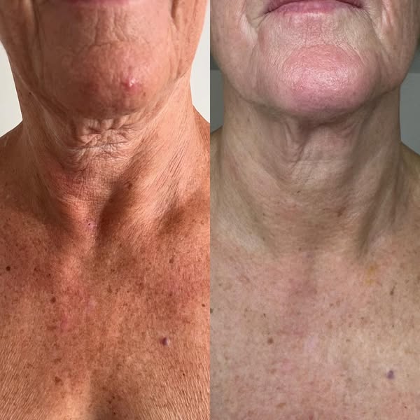 Bellissima Beauty Aesthetics Gallery Image Bellissima Beauty Aesthetics Gallery Image