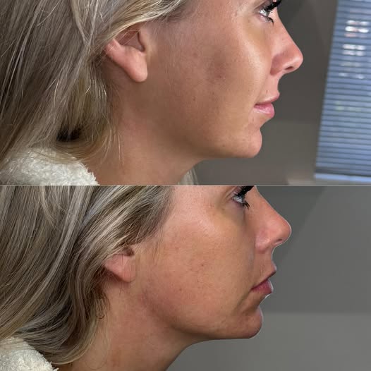 Bellissima Beauty Aesthetics Gallery Image Bellissima Beauty Aesthetics Gallery Image